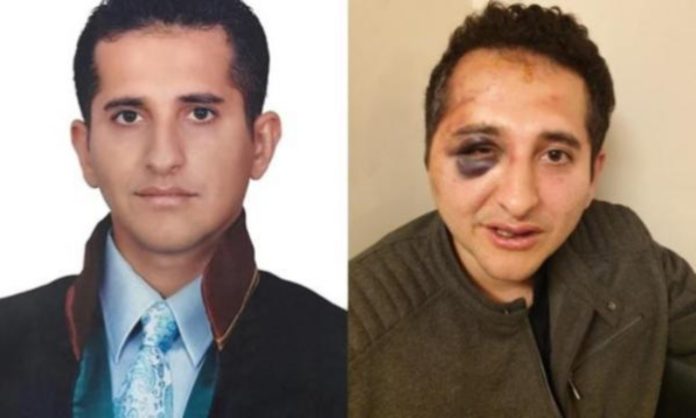 Turkish lawyer claims beaten by Erdoğan’s bodyguards in İstanbul 1