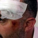 Kurdish politicians handcuffed and beaten by police in Turkey’s east 3
