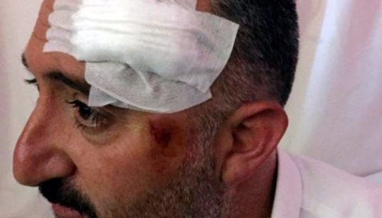 Kurdish politicians handcuffed and beaten by police in Turkey’s east 64