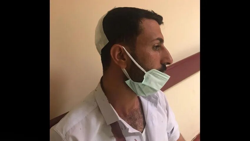 Kurdish man picnicking in SE Turkey injured after security forces fire warning shots 4