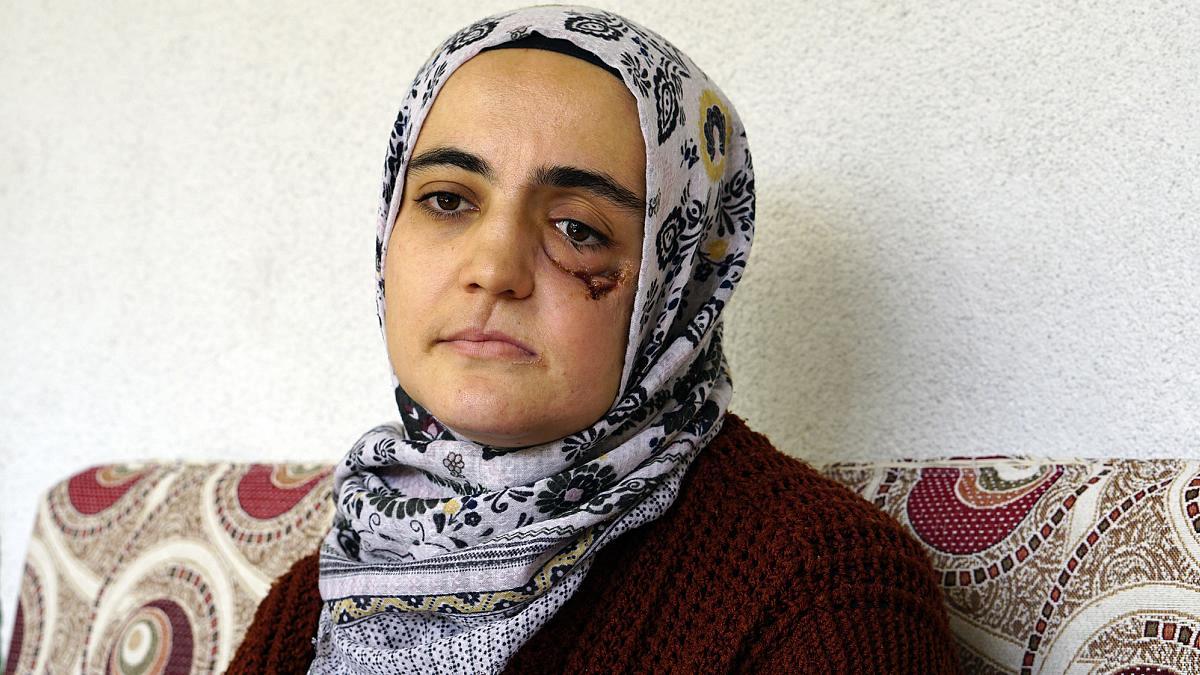Turkey’s top court refuses to postpone incarceration of end-stage cancer patient Ayşe Özdoğan 1