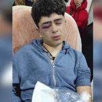 Police torture 14-year-old Kurdish boy in Turkey, leaving him at risk of losing an eye 1